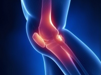 Tipps gegen Arthroseschmerzen